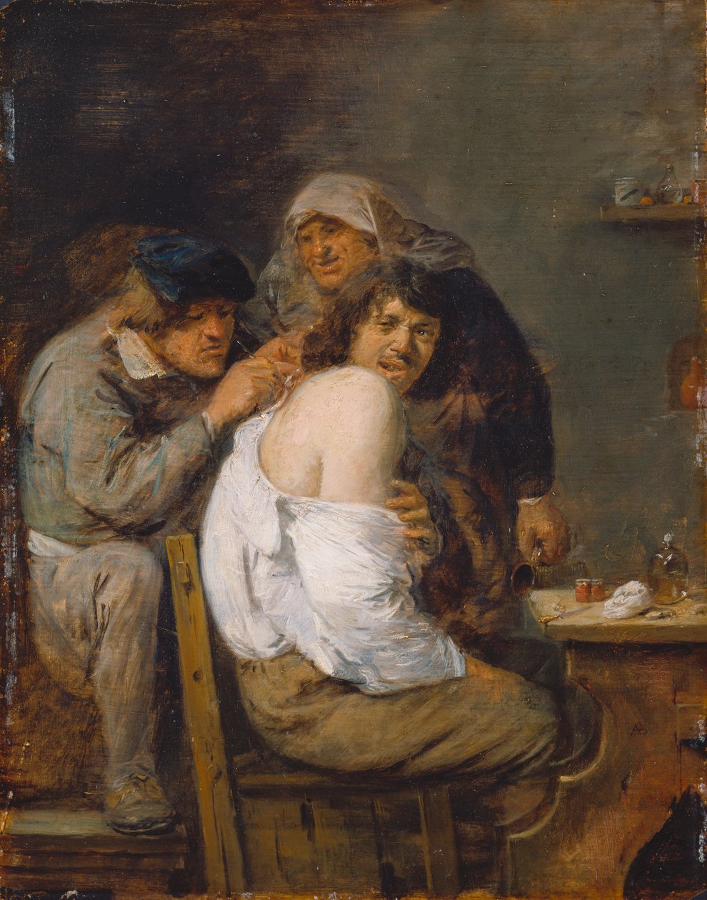 Ryggoperasjonen, ca. 1636 (olje på tre) av Adriaen Brouwer