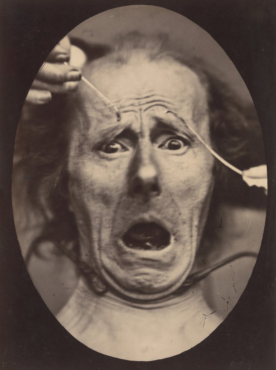 Electro-Physiologie, figur 64, 1854-56, trykt 1862. av Adrien Alban Tournachon