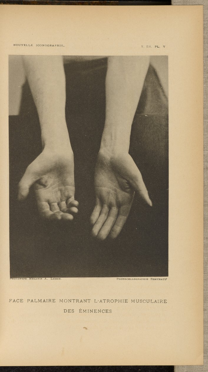  av Albert Londe