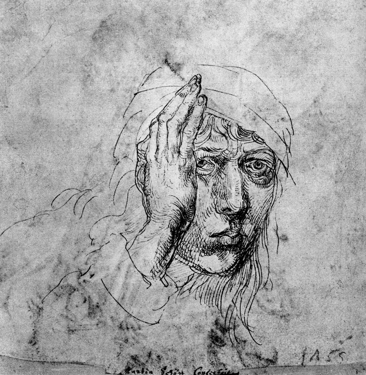 Selvportrett med bandasje, 1492, 1936 av Albrecht Dürer
