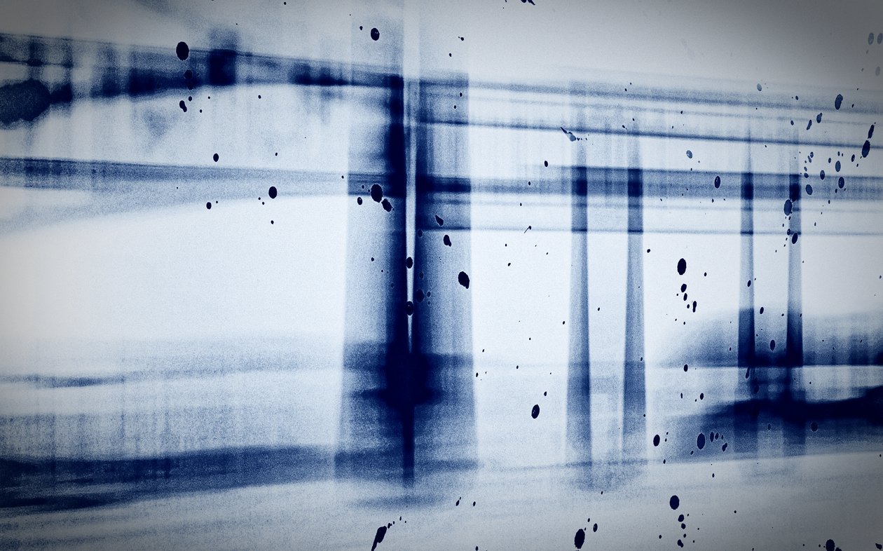 Snø (røntgen), 2019, (fotografi) av Alex Caminker