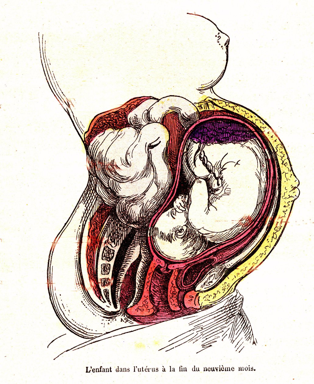 Barnet i livmoren (sen 9. måned) - J. Rengades normale liv og helse - Tegning A.Demarle 1881 av Alphonse Demarle