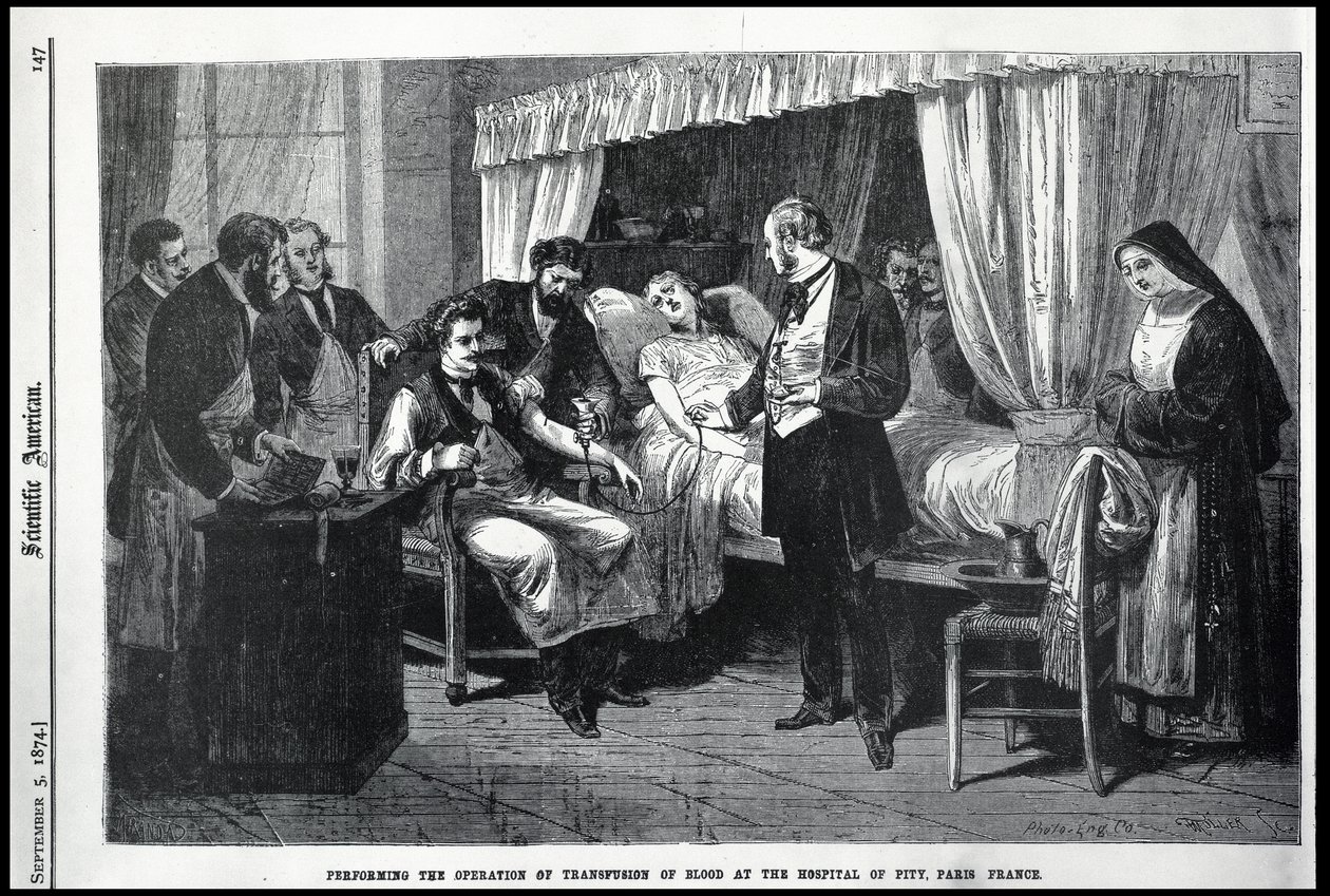 Utføre operasjonen av blodtransfusjon på Hospital of Pity, Paris, Frankrike, illustrasjon fra den amerikanske forskeren av American School