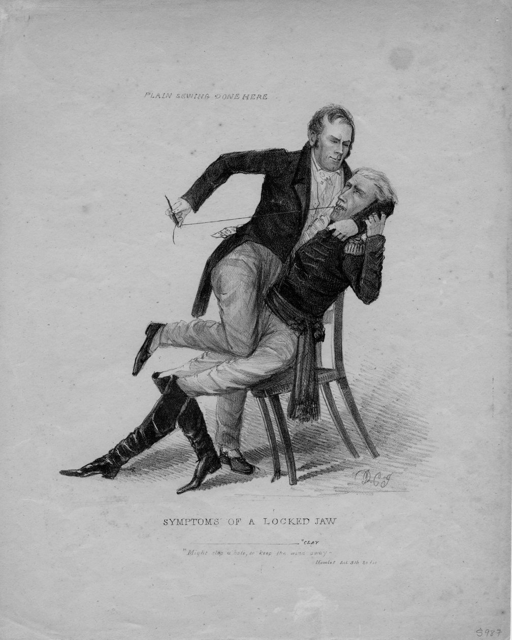 Symptomer på låst kjeve, ca. 1827 av American School