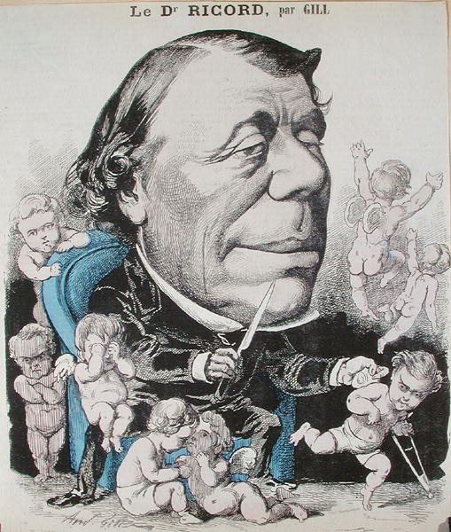 Karikatur av Dr. Philippe Ricord (1800-89) (farget gravering) av Andre Gill