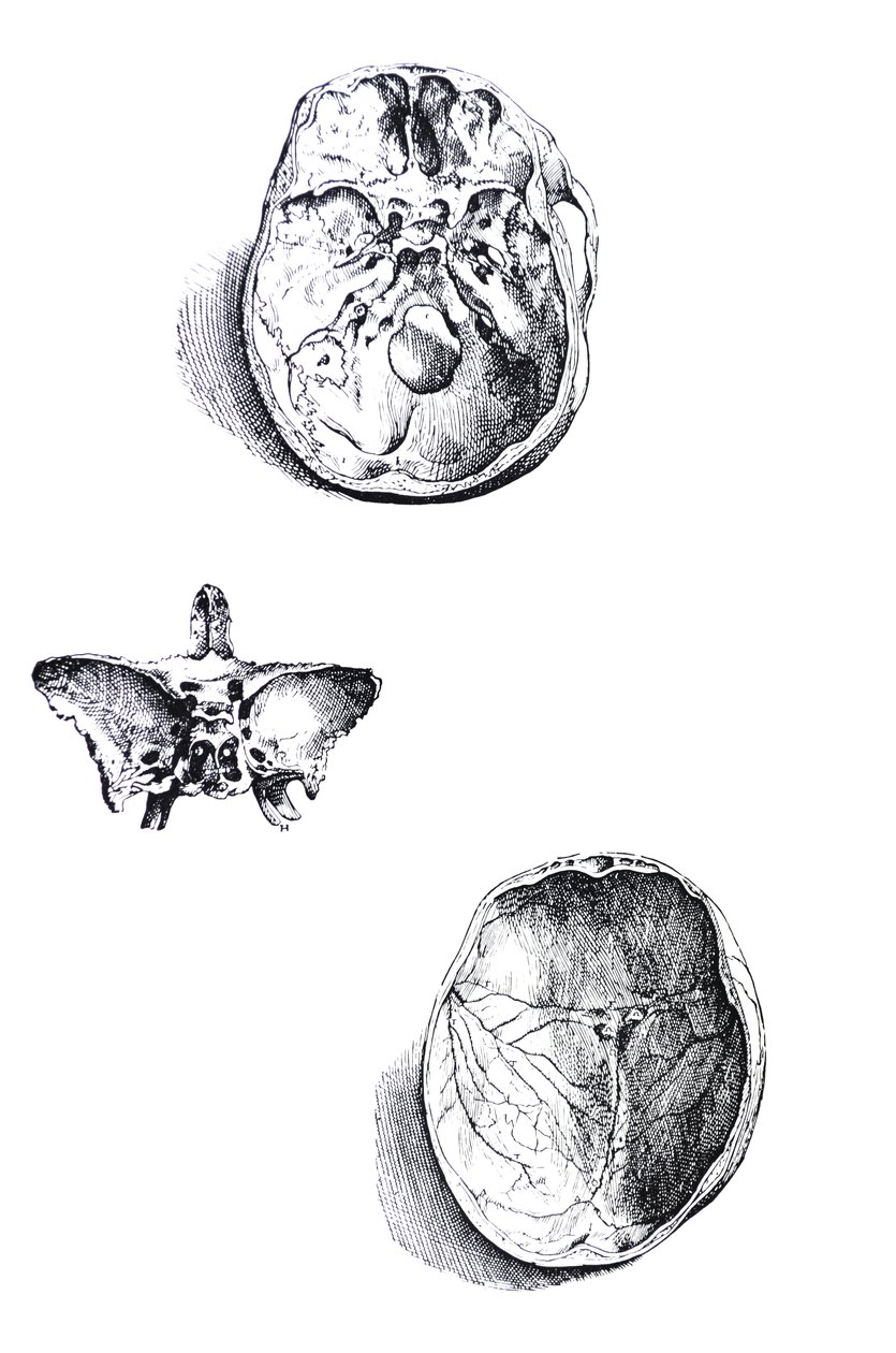 Platene fra den første boken til De Humani Corporis Fabrica av Andreas Vesalius