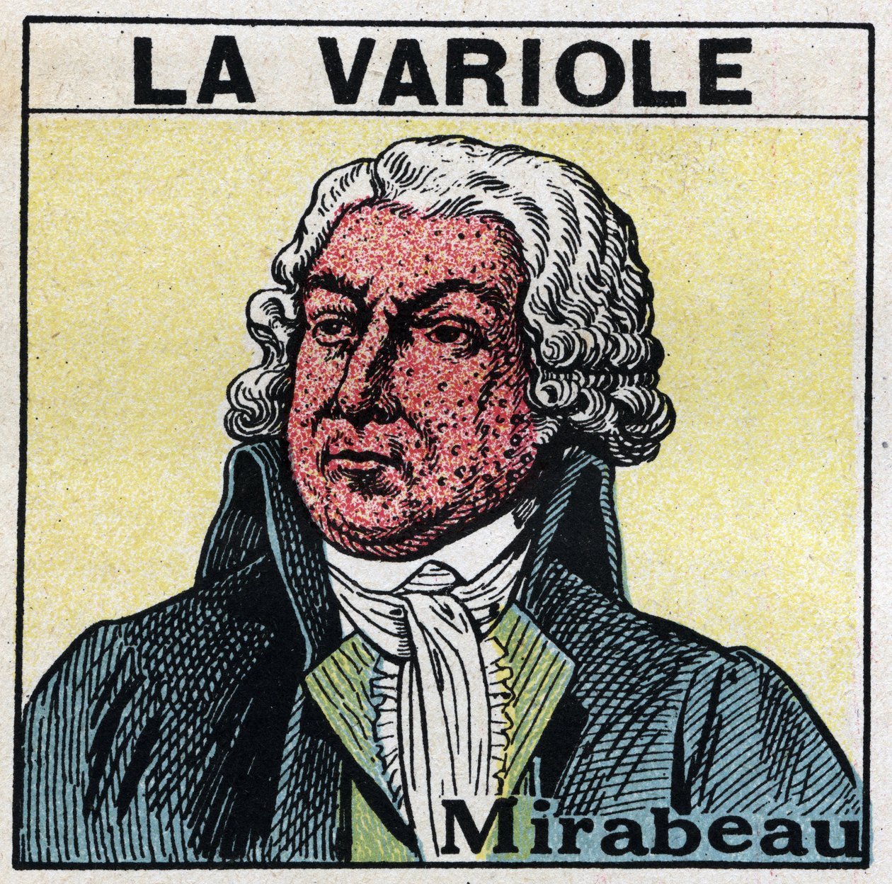 Portrait of Honore Gabriel (Honore-Gabriel) Riqueti, Count of Mirabeau (1749-1791) with the face of figure by smallpox. To avoid scars caused by smallpox, patients should be treated in rooms or enter only red light, free of ultra violet rays. Anonymous ill av Anonymous Anonymous