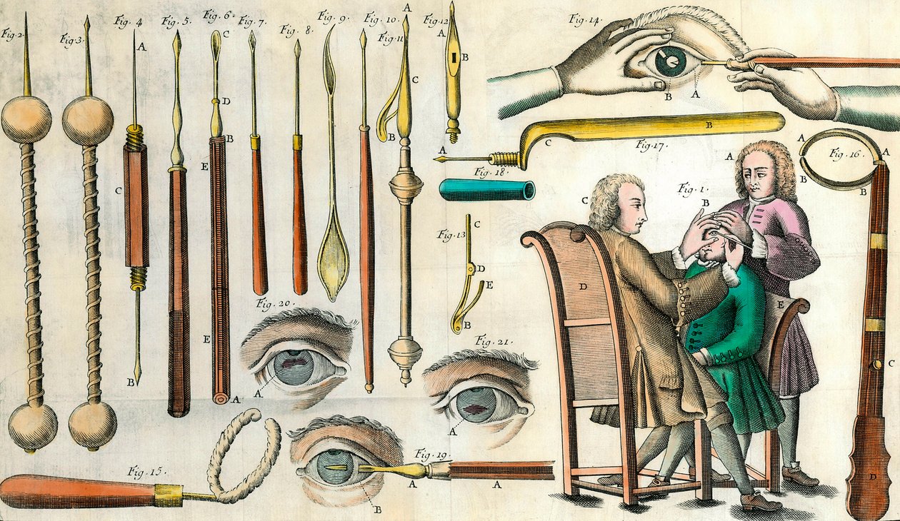Kirurgi på 1700-tallet: øyeoperasjon. Instrumenter for kataraktoperasjon og kunstig pupilldannelse. Gravering i "Institutionis chirurgicae" av Lorenzo Heister av Anonymous Anonymous