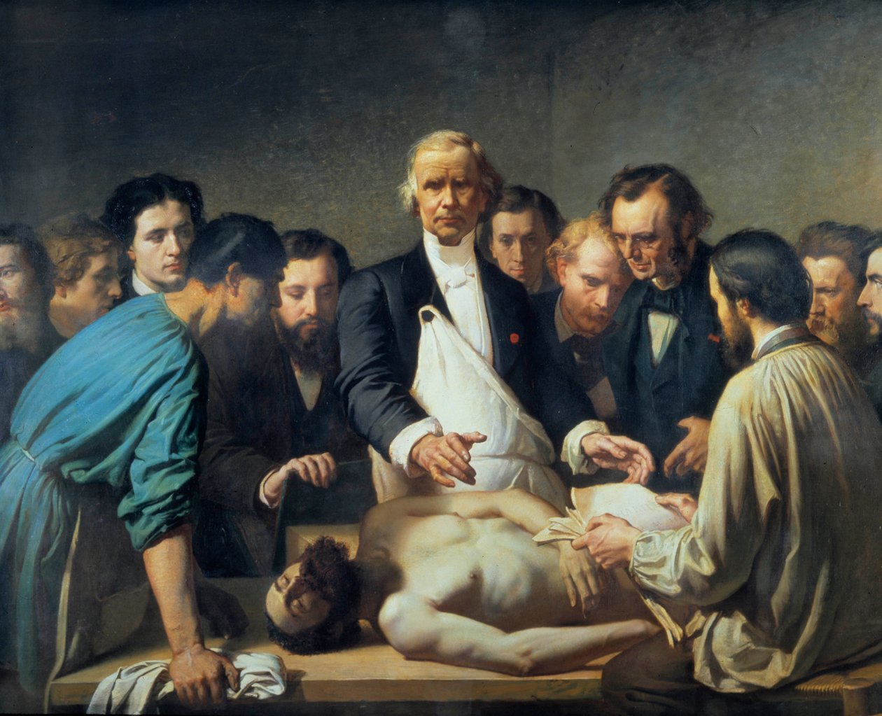 Doktor Alfred Velleau (1795-1867) ved Charity vil gå videre til en obduksjon. En lege omringet av studentene sine som er forberedt på å gripe inn på et lik. Maleri av Francois Feyen Perrin (1826-1888). 1800-tallet. Tours musee des Beaux Arts - Alfred Velpe av Auguste (after) Feyen Perrin