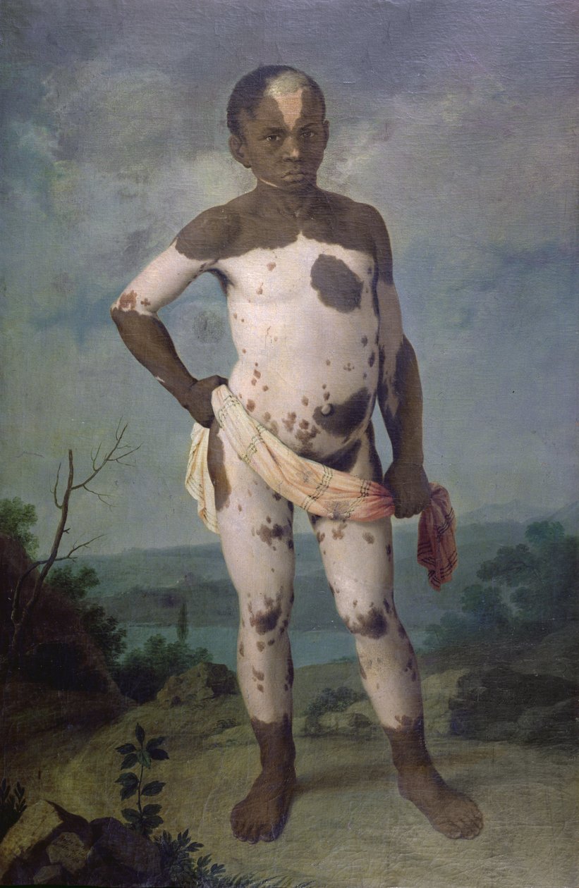 Barn med vitiligo, 1786 av Brazilian School