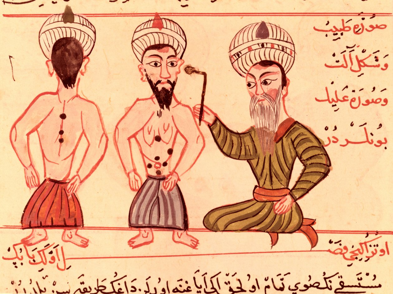 Ms Sup Turc 693 fol.35 Operation for Cauterisation, 1466 av Charaf ed Din