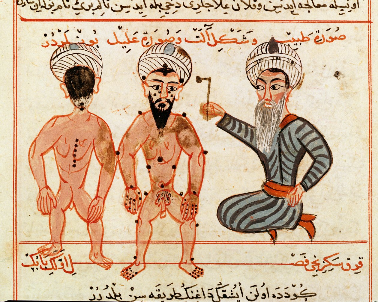 Ms Sup Turc 693 fol.46v Cauterization of leprasy lesjoner, 1466 av Charaf ed Din