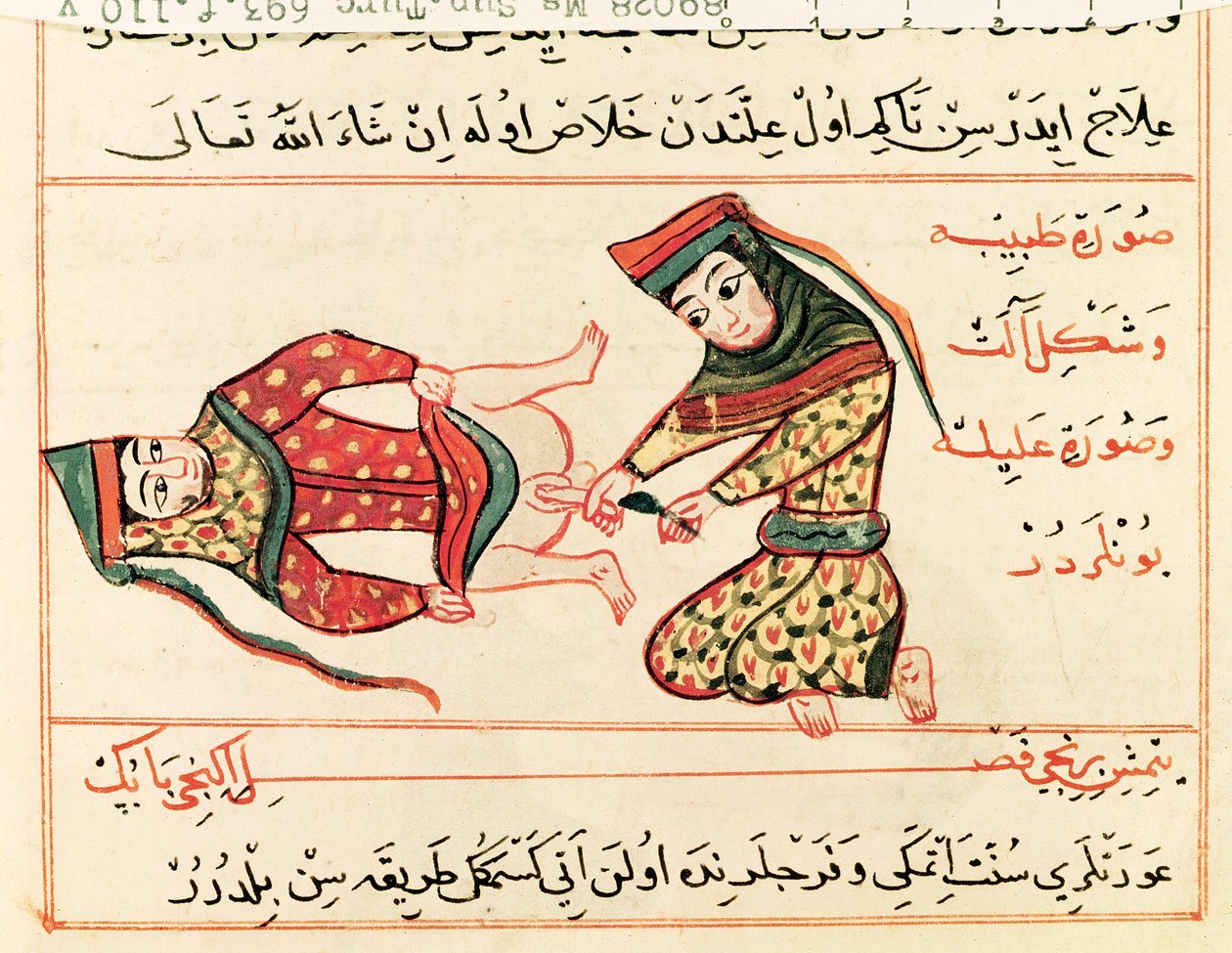 Ms Sup Turc 693 fol.110v Jordmor som opererer på en hermafroditt, 1466 av Charaf ed Din