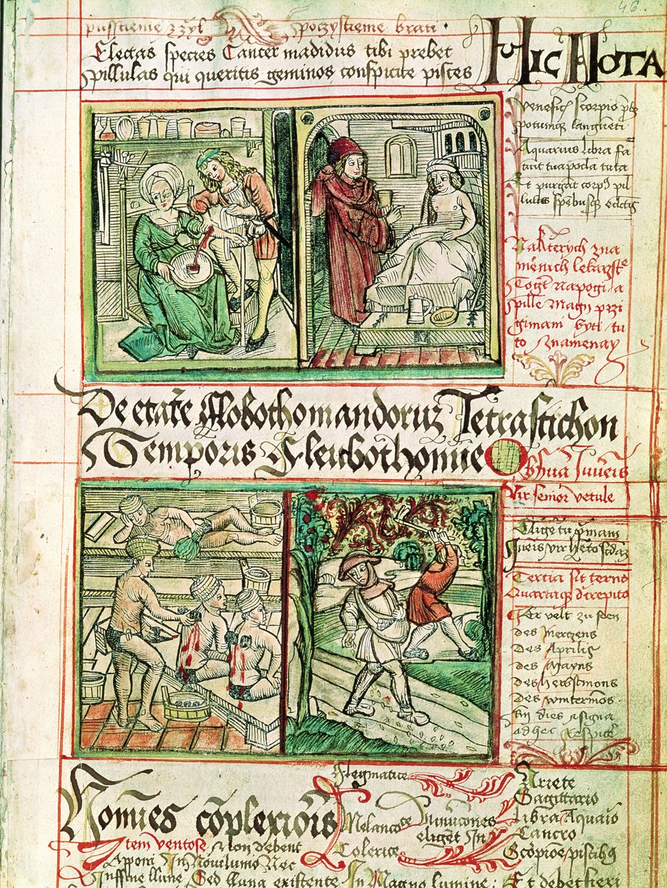 Hvordan kurere sykdommer, fra Tractatus de Pestilencia av Czech School