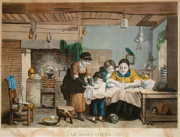 The Cut Finger, gravert av Joly, ca. 1830-40 (farget gravering) av David (after) Wilkie