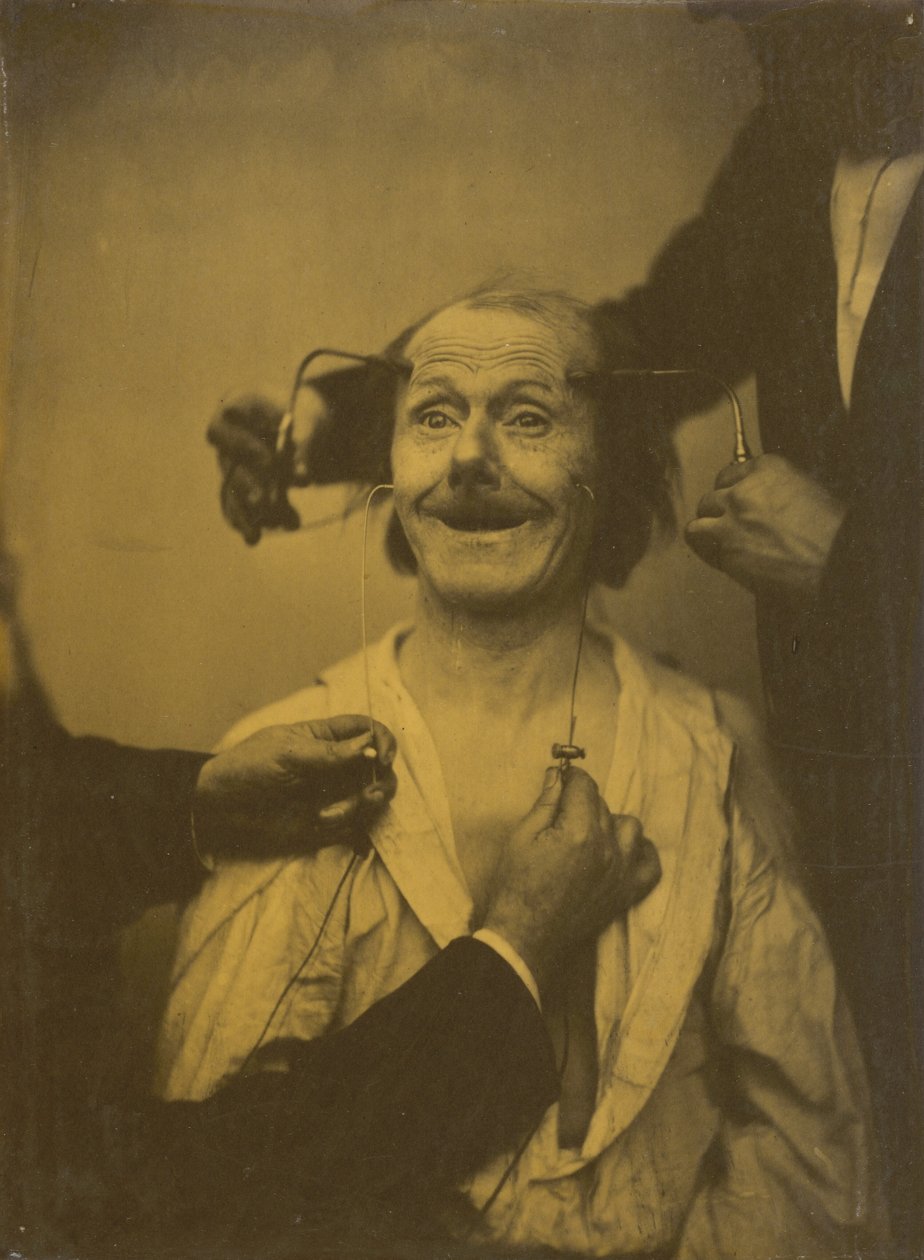 Et falskt, ufullstendig uttrykk for behagelig overraskelse eller beundring, 1854-1856, trykt 1862. av Duchenne de Boulogne