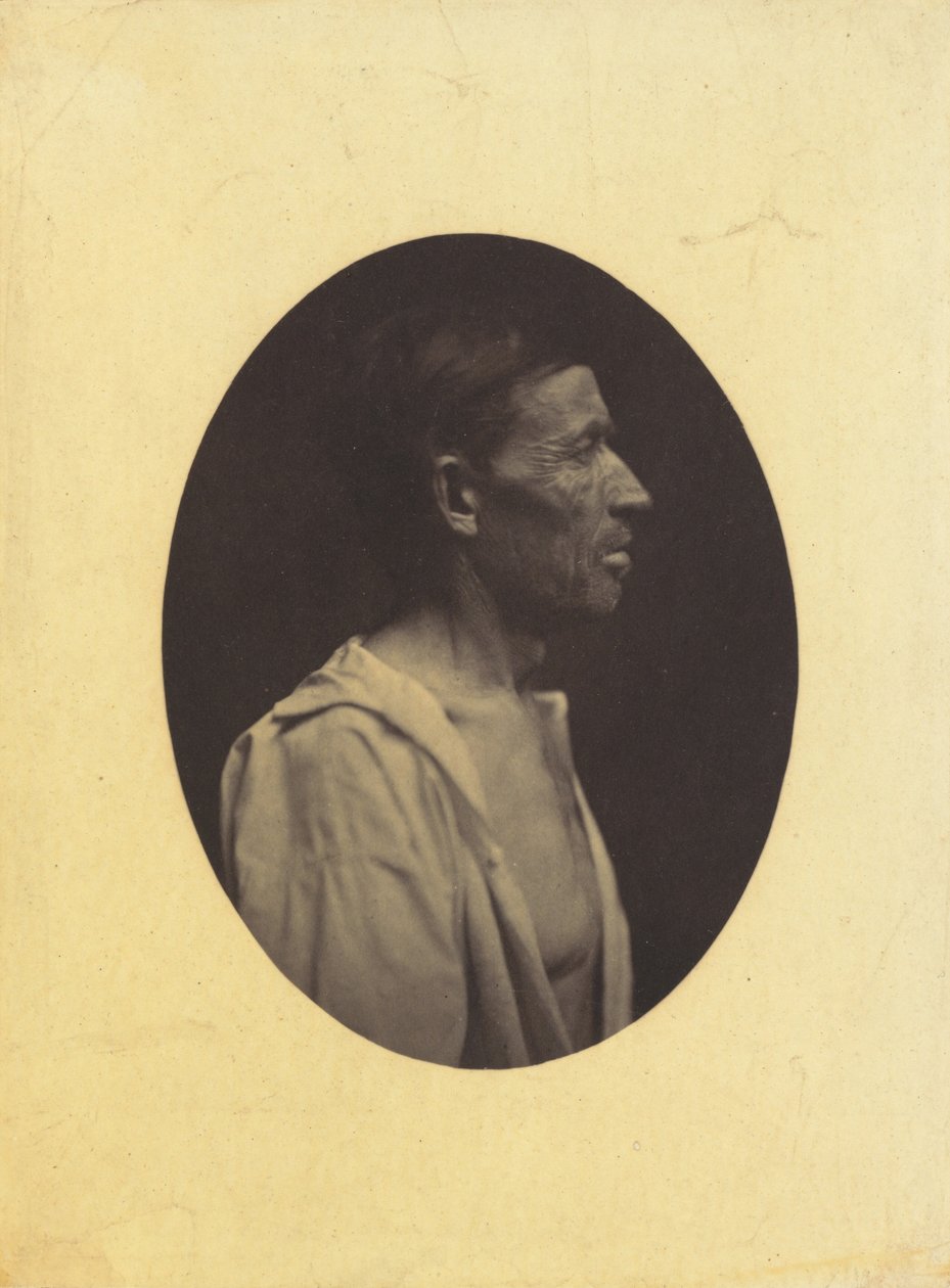 Et portrett, sett i profil, av en mann 42 år gammel, bedøvet av misbruk av alkohol..., 1854-1856. av Duchenne de Boulogne