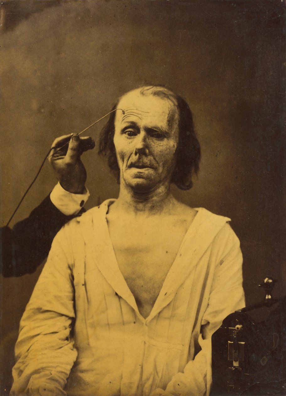 Et avslappet ansikt venstre, dyp oppmerksomhet høyre, 1854-1856, trykt 1862. av Duchenne de Boulogne