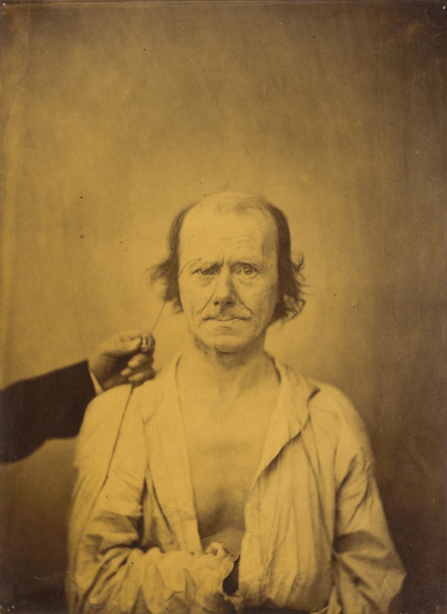 Oppmerksomhet venstre, Refleksjon høyre, 1854-1856, trykt 1862. av Duchenne de Boulogne