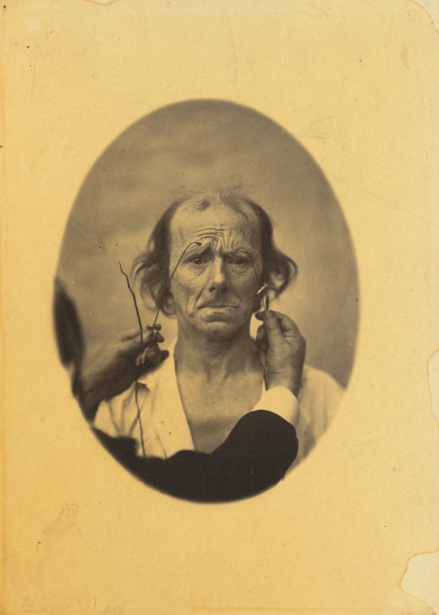 Misnøye, dystre tanker venstre, Refleksjon høyre, 1854-1856, trykt 1862. av Duchenne de Boulogne