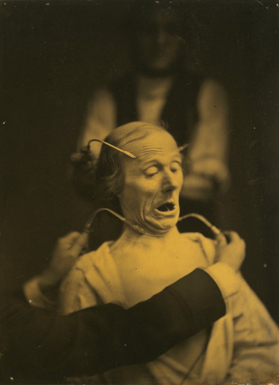 Uttrykk for terror, 1854-1856, trykt 1862. av Duchenne de Boulogne
