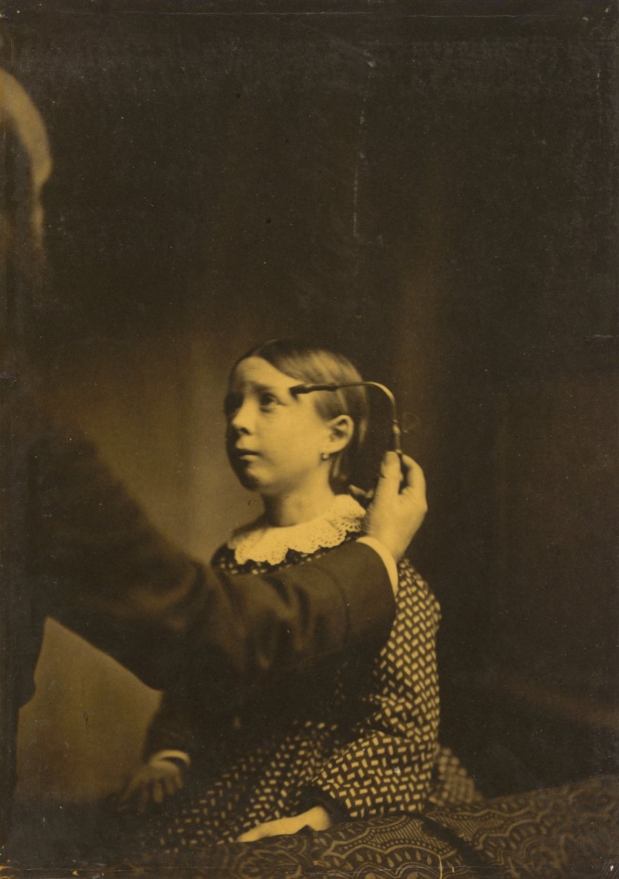 Smertefulle minner, 1854-1856, trykt 1862. av Duchenne de Boulogne