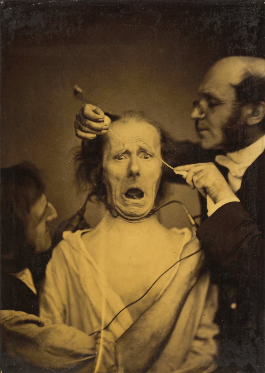 Terror blandet med smerte, tortur, 1854-1856, trykt 1862. av Duchenne de Boulogne
