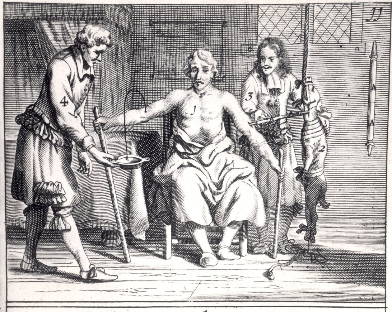 Blodoverføring fra en hund, fra Armamentarii Chirurgici av Johannes Schultes (1595-1645) utgitt i Amsterdam, 1671 av Dutch School