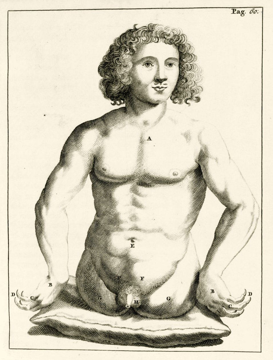 Eksempel på medfødte misdannelser av Frederik Dekkers, 1694 av Dutch School