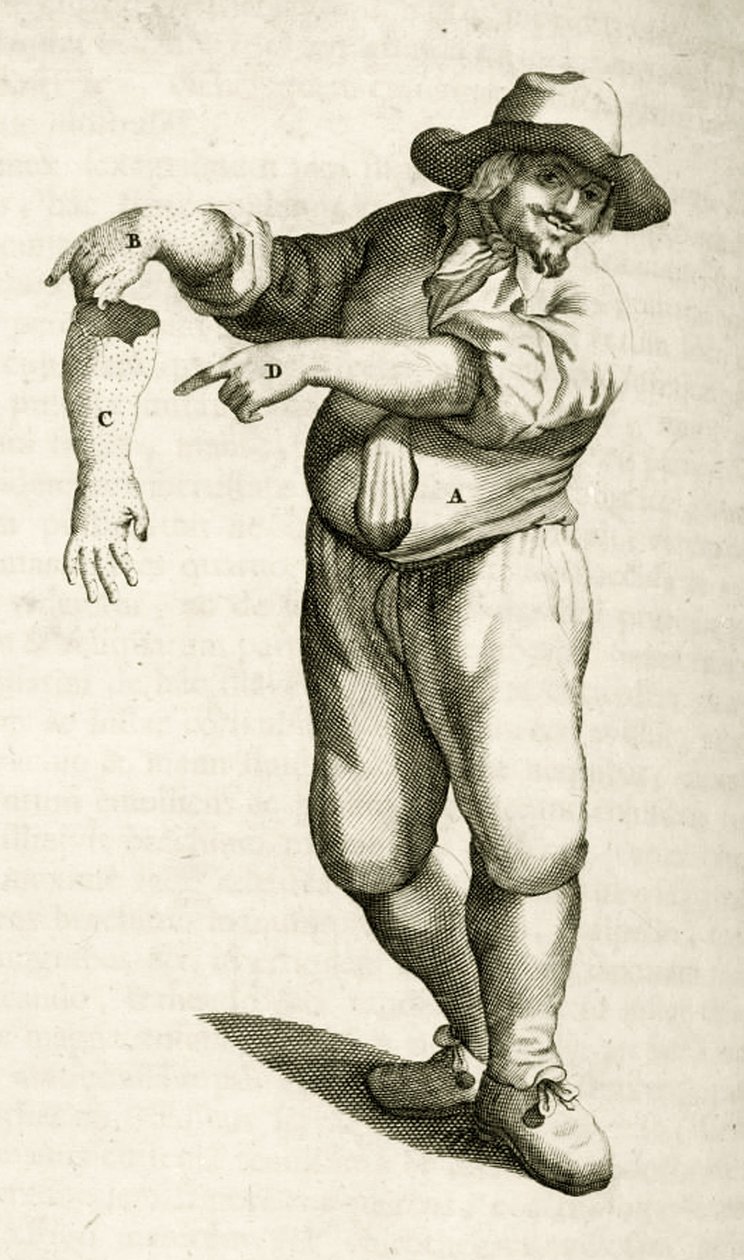 Fjerning av død hud med pustler, fra Practical Exercises in Medical Methods av Frederik Dekkers, 1694 av Dutch School