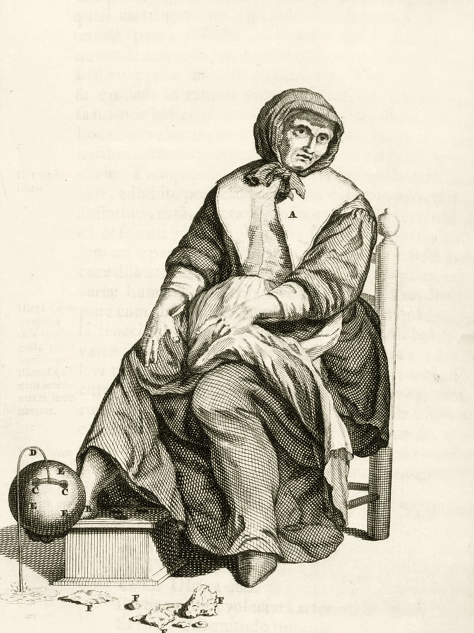 Using a Mechanical Leech, fra Practical Exercises concerning the Method of Healing av Frederik Dekkers, 1694 av Dutch School