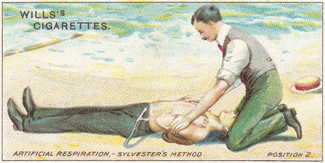 Kunstig åndedrett, Sylvester