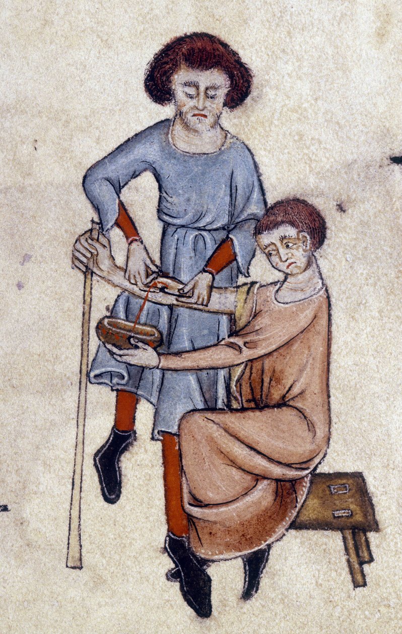 Blood Letting, fra Luttrell Psalter, ca. 1325-35 (vellum) av English School