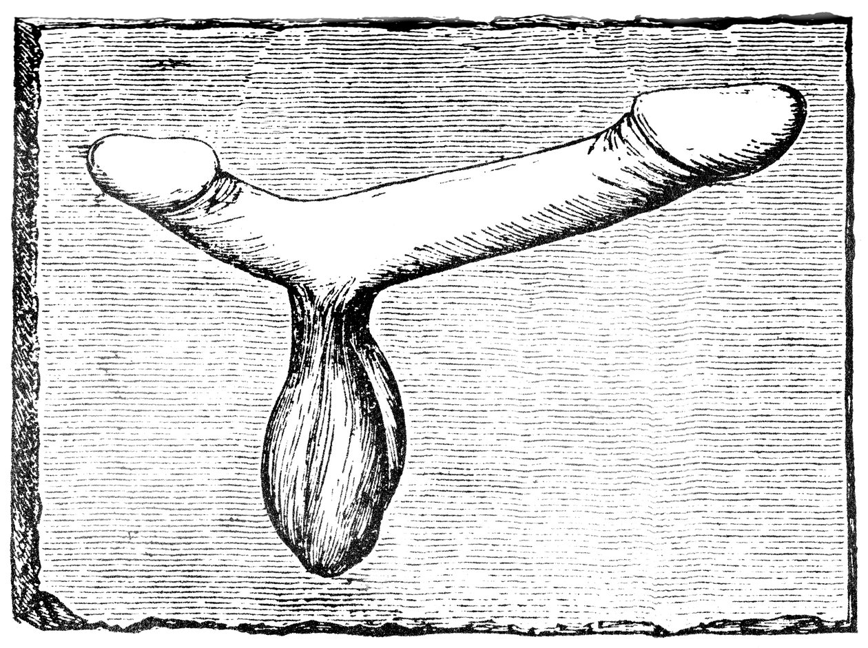 Dobbel fallus fra overliggeren til et vomitorium (utgangspassasje) ved Nimes (Colonia Nemausus) amfiteater av English School