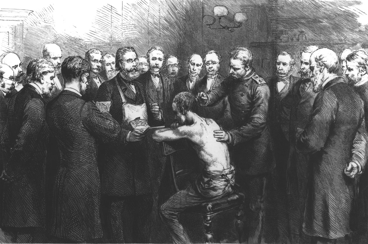 Dr Kochs behandling for forbruk ved Royal Hospital, Berlin: Professor Pfuhl inokulerer en pasient med lymfen av English School
