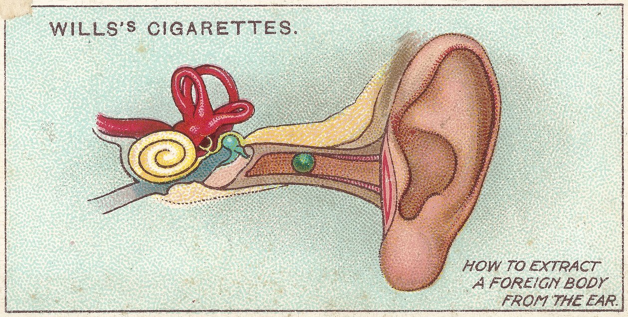Fremmedlegeme i øret, nr. 30 fra First Aid-serien med Willss sigarettkort, 1913 av English School