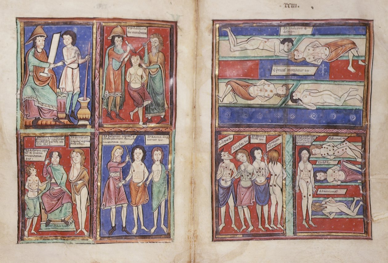 Sloane 1975 fol.91v-92 Medisinske scener av English School