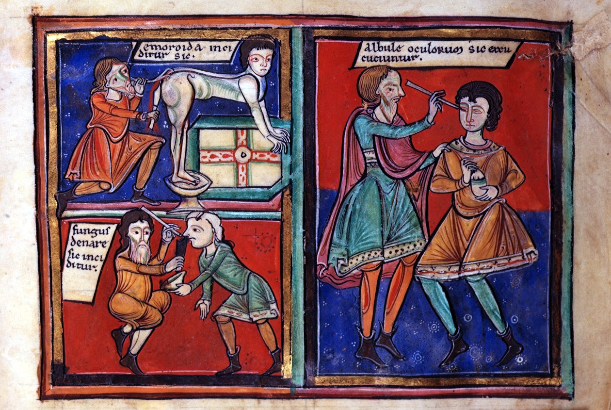 Sloane Ms 1975 fol.93 Medisinske operasjoner av English School