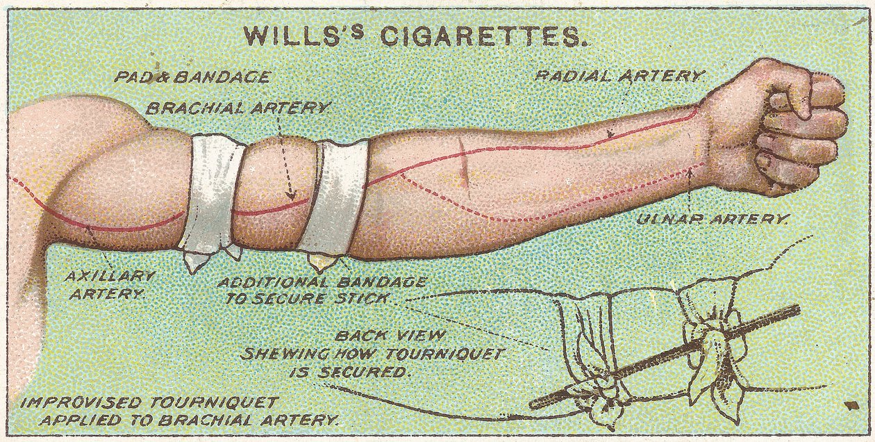 Tourniquet, nr. 11 fra First Aid-serien med Willss Cigarettes-kort, 1913 av English School