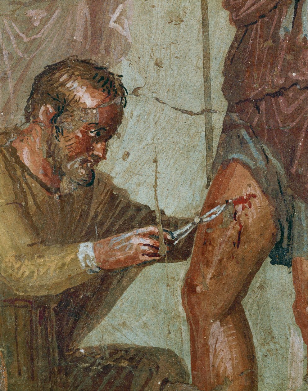 Den sårede Aeneas mellom Venus og Ascanius (freske) av Erich Lessing