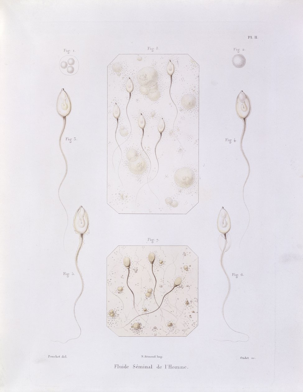 Sædvæske, fra Theorie Positive de lOvulation Spontanee et de la Fecondation des Mammiferes et de lEspece Humaine av Felix-Archimede Pouchet (1800-72) gravert av Oudet, Paris, 1847 (farget eng. av Felix Archimede Pouchet