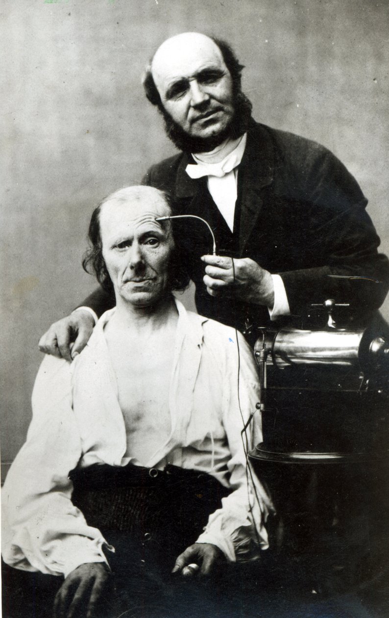 Duchenne de Boulogne med en offerpasient, 1862 av French Photographer