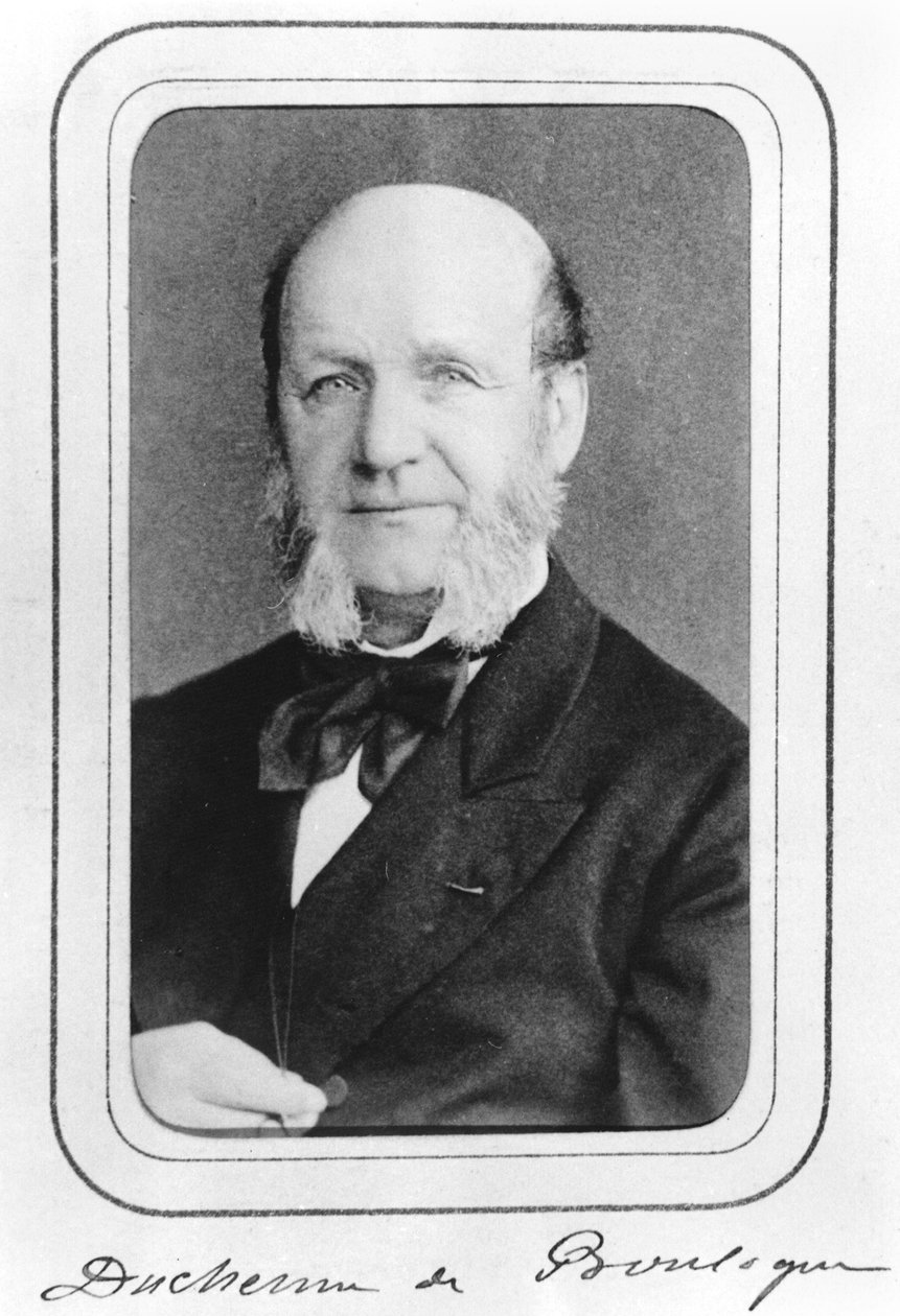William Benjamin Duchenne av Boulogne (1806-75) av French Photographer