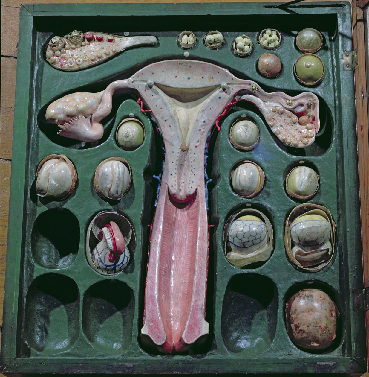 Kvinnelige kjønnsorganer, ca. 1830 (malt papp) av French School