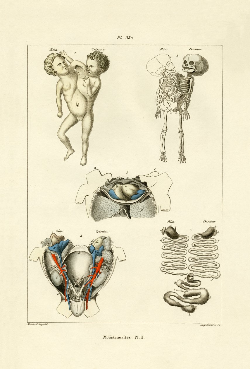 Freak, 1833-39 av French School