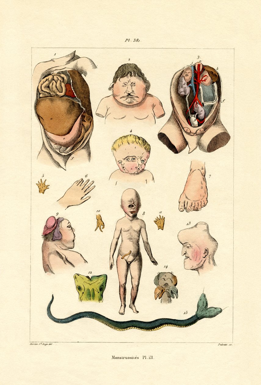 Freak, 1833-39 av French School