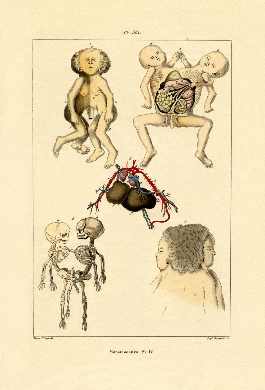 Freak, 1833-39 av French School