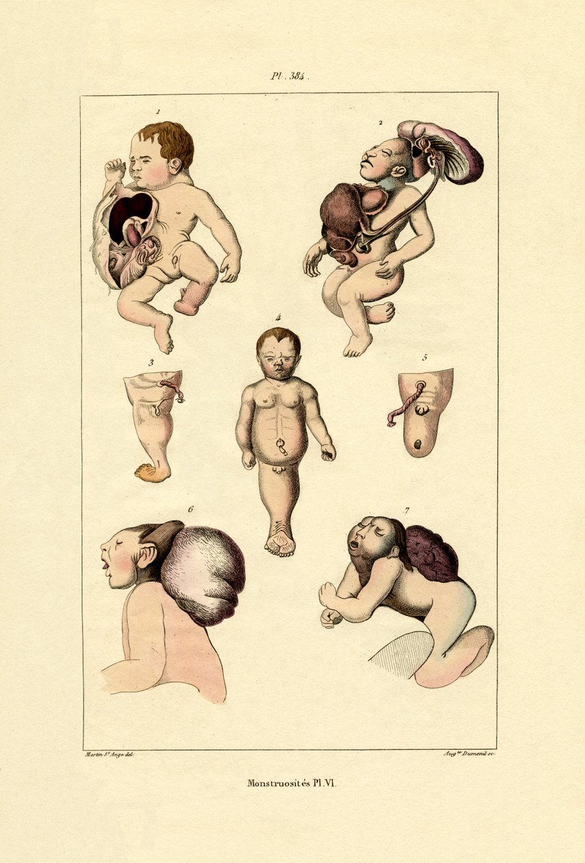 Freak, 1833-39 av French School