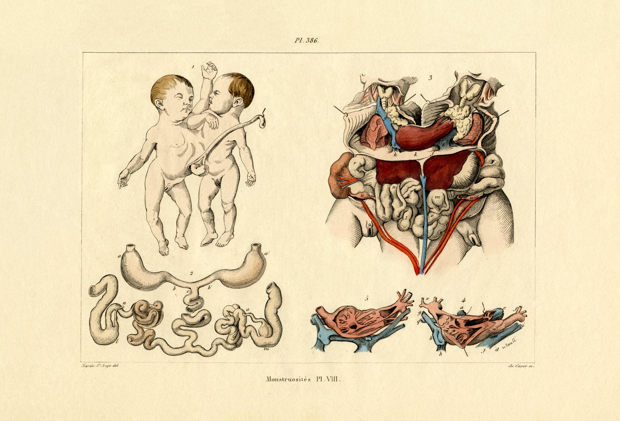 Freak, 1833-39 av French School