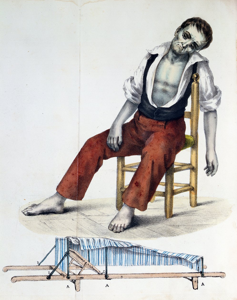 Cholera Morbus, fra Relation, History, Statistics and Medicine of Cholera-Morbus av Francisco dAssis de Souza Vaz, 1833 av French School
